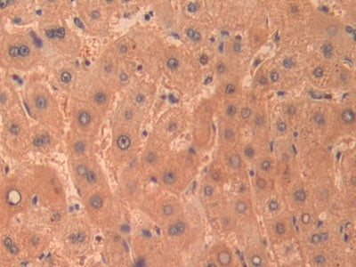 DAB staining on IHC-P; Samples: Human Kidney Tissue