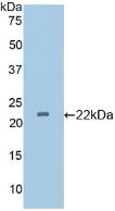 Used in DAB staining on fromalin fixed paraffin-embedded Kidney tissue