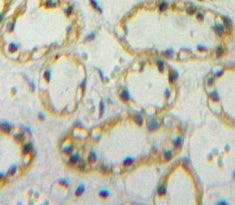 Cluster Of Differentiation 36 (CD36) Polyclonal Antibody - image 4