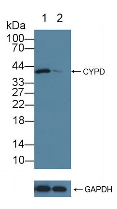 DAB staining on IHC-P; Samples: Human Liver cancer Tissue; Primary Ab: 10µg/ml Rabbit Anti-Human CYPD Antibody Second Ab: 2µg/mL HRP-Linked Caprine Anti-Rabbit IgG Polyclonal Antibody