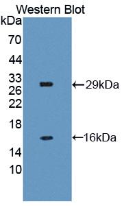 Neuronal Apoptosis Inhibitory Protein (NAIP) Polyclonal Antibody - image 2