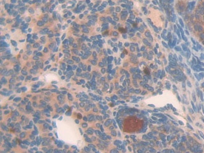DAB staining on IHC-P; Samples: Mouse Placenta Tissue