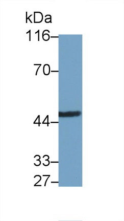 DAB staining on IHC-P; Samples: Human Cardiac Muscle Tissue; Primary Ab: 20μg/ml Rabbit Anti-Human IRAK4 Antibody Second Ab: 2µg/mL HRP-Linked Caprine Anti-Rabbit IgG Polyclonal Antibody