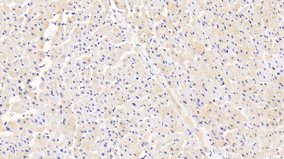 DAB staining on IHC-P. Samples: Human Tissue)