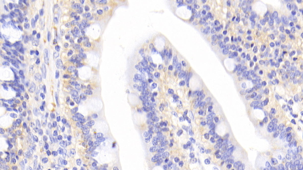 Interleukin 1 Receptor Associated Kinase 4 (IRAK4) Polyclonal Antibody - image 5