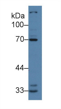 Western Blot; Sample: Recombinant protein.