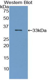 DAB staining on IHC-P; Samples: Human Stomach Tissue; Primary Ab: 10µg/ml Rabbit Anti-Human IRAK2 Antibody Second Ab: 2µg/mL HRP-Linked Caprine Anti-Rabbit IgG Polyclonal Antibody
