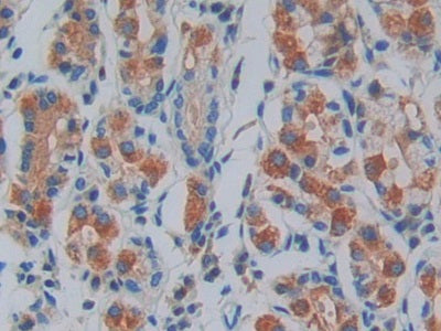 Interleukin 1 Receptor Associated Kinase 2 (IRAK2) Polyclonal Antibody - image 5