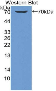 Killer Cell Immunoglobulin Like Receptor 2DL1 (KIR2DL1) Polyclonal Antibody - image 2