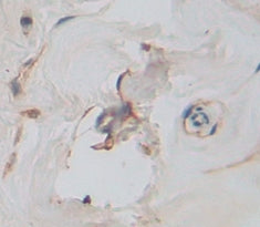 Killer Cell Immunoglobulin Like Receptor 2DL1 (KIR2DL1) Polyclonal Antibody - image 3