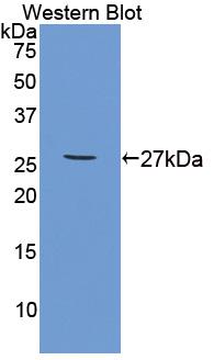 Tumor Necrosis Factor Receptor Superfamily, Member 1B (TNFRSF1B) Polyclonal Antibody - image 2