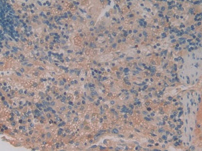 DAB staining on fromalin fixed paraffin- embedded testis tissue)