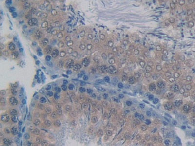 Tumor Necrosis Factor Receptor Superfamily, Member 1B (TNFRSF1B) Polyclonal Antibody - image 4