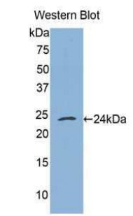 Western Blot; Sample: Rat Kidney lysate; ; Primary Ab: 2µg/ml Rabbit Anti-Rat TNFRSF1A Antibody; Second Ab: 0.2µg/mL HRP-Linked Caprine Anti-Rabbit IgG Polyclonal Antibody;