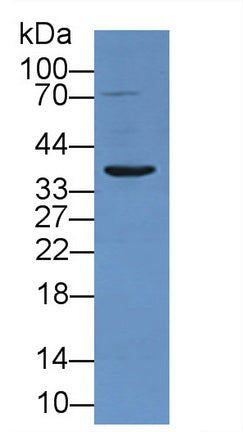 DAB staining on IHC-P; Samples: Rat Kidney Tissue; Primary Ab: 20µg/ml Rabbit Anti-Rat TNFRSF1A Antibody Second Ab: 2µg/mL HRP-Linked Caprine Anti-Rabbit IgG Polyclonal Antibody