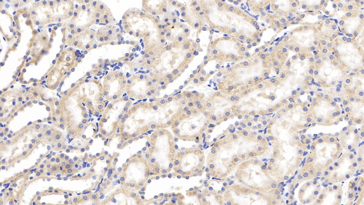 DABstainingonIHC-P.Samples:RatTissue)
