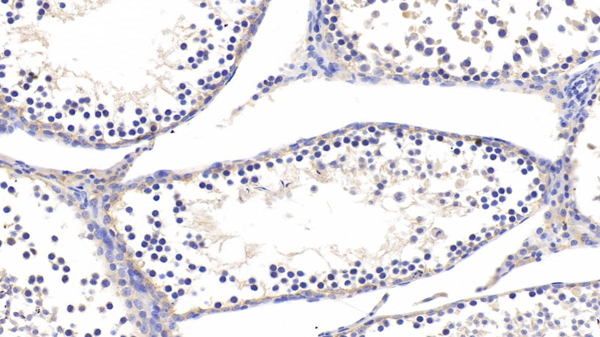 Tumor Necrosis Factor Receptor 1 (TNFR1) Polyclonal Antibody - image 5