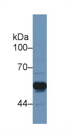 Western Blot; Sample: Recombinant protein.