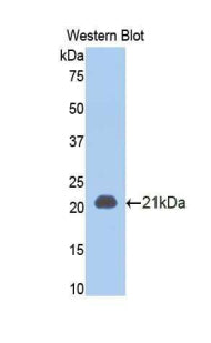 DAB staining on IHC-P; Samples: Rat Kidney Tissue; Primary Ab: 20μg/ml Rabbit Anti-Rat TNFRSF1A Antibody Second Ab: 2µg/mL HRP-Linked Caprine Anti-Rabbit IgG Polyclonal Antibody