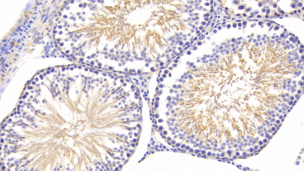 Tumor Necrosis Factor Receptor 1 (TNFR1) Polyclonal Antibody - image 5