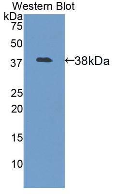 DAB staining on IHC-P; Samples: Mouse Kidney Tissue;  Primary Ab: 20µg/ml   Rabbit Anti-Mouse LUM Antibody Second Ab: 2µg/mL HRP-Linked Caprine Anti-Rabbit IgG Polyclonal Antibody