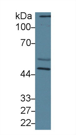 Western Blot; Sample: Recombinant protein.