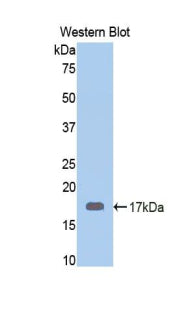 DAB staining on IHC-P; Samples: Human Stomach Tissue; Primary Ab: 20μg/ml Rabbit Anti-Human CRT Antibody Second Ab: 2µg/mL HRP-Linked Caprine Anti-Rabbit IgG Polyclonal Antibody