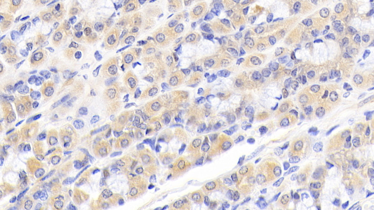 DAB staining on fromalin fixed paraffin-embedded Kidney tissue)
