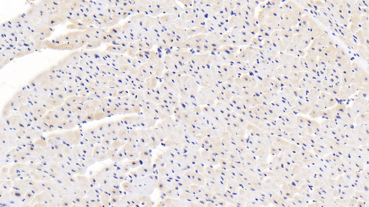 Calreticulin (CALR) Polyclonal Antibody - image 5