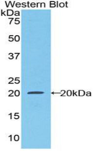 Colony Stimulating Factor Receptor, Macrophage (MCSFR) Polyclonal Antibody - image 2