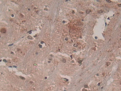 Colony Stimulating Factor Receptor, Macrophage (MCSFR) Polyclonal Antibody - image 4