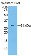 Pitrilysin Metalloproteinase 1 (MP1) Polyclonal Antibody - image 2