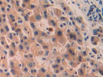 Pitrilysin Metalloproteinase 1 (MP1) Polyclonal Antibody - image 4