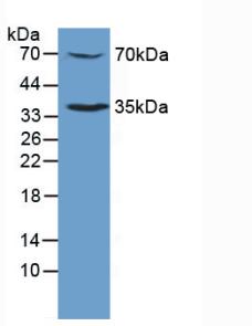 Western Blot; Sample: Recombinant MPL, Human.