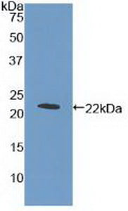 Used in DAB staining on fromalin fixed paraffin-embedded Stomach tissue