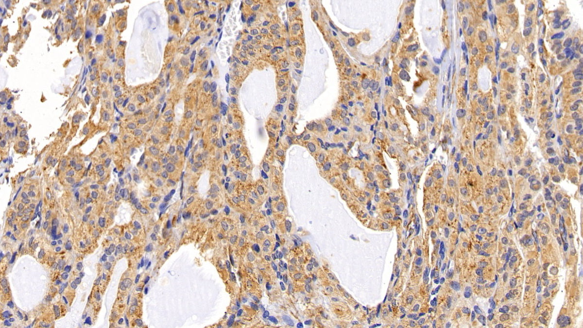 DABstainingonIHC-P.Samples:HumanTissue)