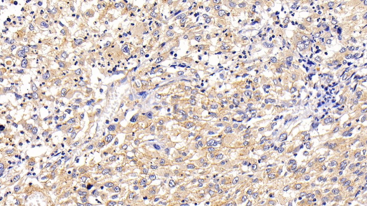 Lysosomal Associated Membrane Protein 2 (LAMP2) Polyclonal Antibody - image 4