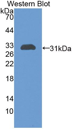 Chitinase-3-like Protein 1 (CHI3L1) Polyclonal Antibody - image 2