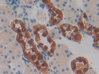 DAB staining on IHC-P; Samples: Rat Kidney Tissue