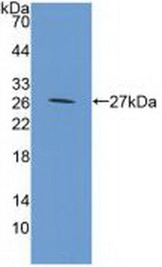 DAB staining on IHC-P; Samples: Mouse Liver Tissue;  Primary Ab: 20μg/ml Rabbit Anti-Mouse GP39 Antibody Second Ab: 2µg/mL HRP-Linked Caprine Anti-Rabbit IgG Polyclonal Antibody