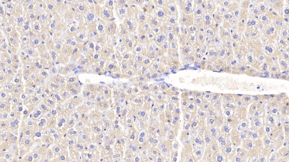 Chitinase-3-like Protein 1 (CHI3L1) Polyclonal Antibody - image 4