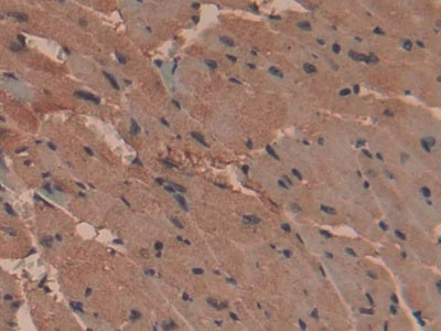 DAB staining on fromalin fixed paraffin- embedded stomach tissue)