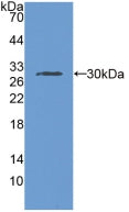 DAB staining on IHC-P; Samples: Human Glioma Tissue; Primary Ab: 10µg/ml Rabbit Anti-Human RNPEP Antibody Second Ab: 2µg/mL HRP-Linked Caprine Anti-Rabbit IgG Polyclonal Antibody