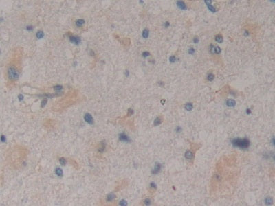 DAB staining on IHC-P; Samples: Human Kidney Tissue.