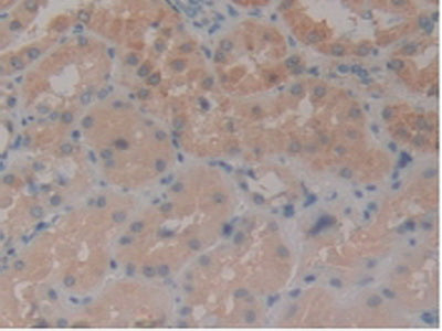 Aminopeptidase B (RNPEP) Polyclonal Antibody - image 5
