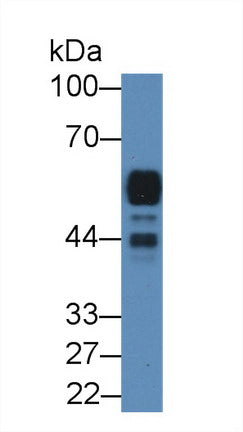 Western Blot; Sample: Recombinant protein.