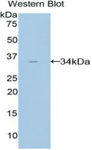 Amylase, Alpha 2A (AMY2A) Polyclonal Antibody - image 3