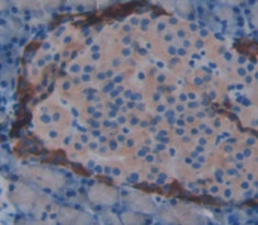 Amylase, Alpha 2A (AMY2A) Polyclonal Antibody - image 4