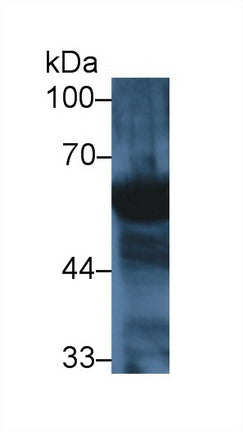 Western Blot; Sample: Recombinant protein.