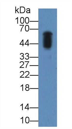 Amylase, Alpha 2A (AMY2A) Polyclonal Antibody - image 3